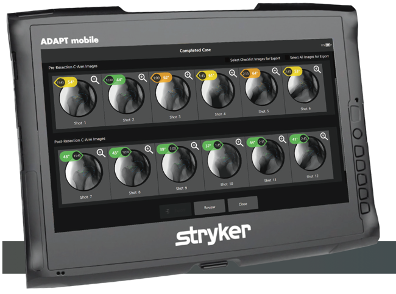 stryker left