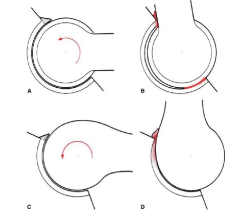 figure 1 figure 1