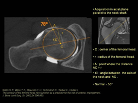 MRI MRI